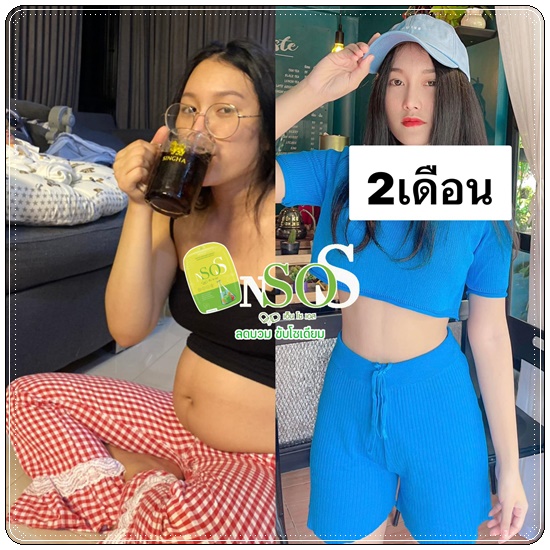N So S ลดบวม ขับโซเดียม (1แถม1)
