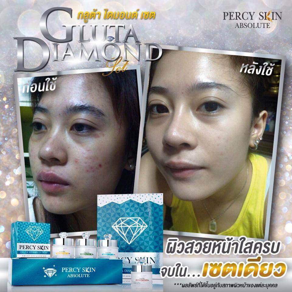 กลูต้า ไดมอนด์ เซต (Gluta Diamond Set By percyskin)