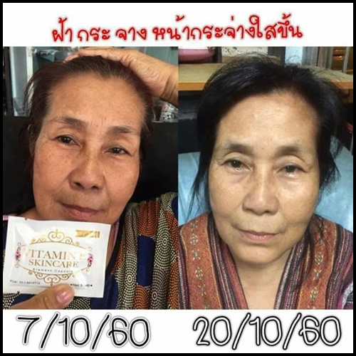วิตามินอี บำรุงผิวหน้า By Nifty (Vitamin E Skincare)