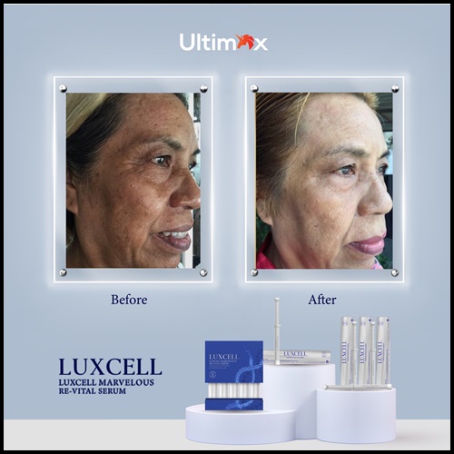 เซรั่มหน้าเด็ก Luxcell คุณภาพระดับสเต็มเซลล์ ของแท้