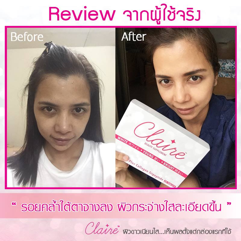 แคลร์ อาหารเสริมผิวขาวใส by วุ้นเส้น(CLAIRE Beauty Supplement)