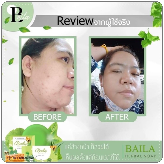 สบู่ใบล่า Baila Herbal Soap DAIME