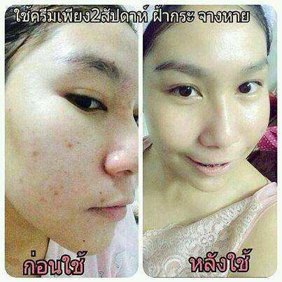ครีมหน้าขาว (Princess White)