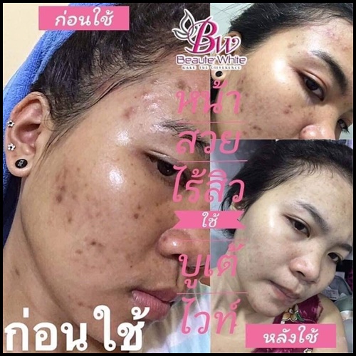 บูเต้ไวท์ เวชสำอางค์ BW Beaute White เซ็ตเล็ก