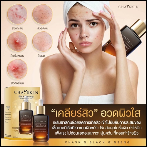 ชาสกิน เซรั่มสลายฝ้า CHASKIN Black Ginseng Serum (ส่งฟรี)