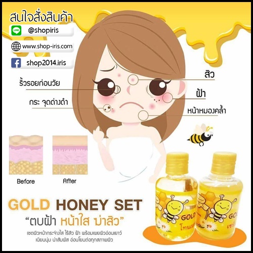โกล ฮันนี่ เซต Gold Honey Set ตบฝ้า หน้าใส ฆ่าสิว