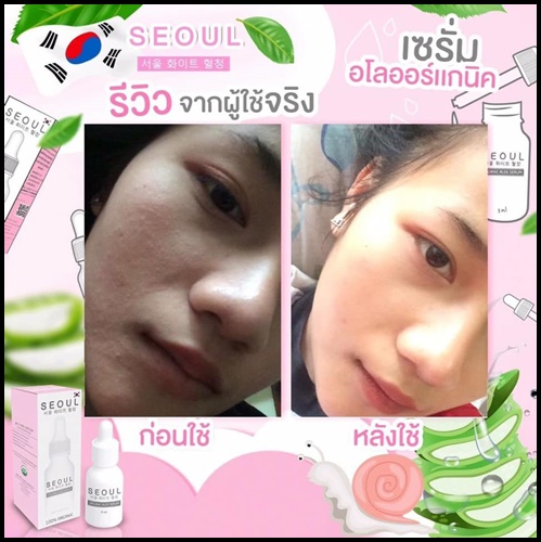 เซรั่มโซล Seoul Organic Aloe Serum เซรั่มอโลออร์แกนิค เข้มข้น