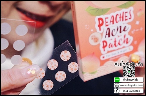 เเผ่นเเปะสิว พีชเชส PEACHES