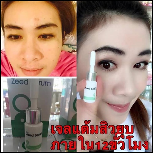 ซี๊ด เซรั่ม เจลแต้มสิวอักเสบ Zeed Serum