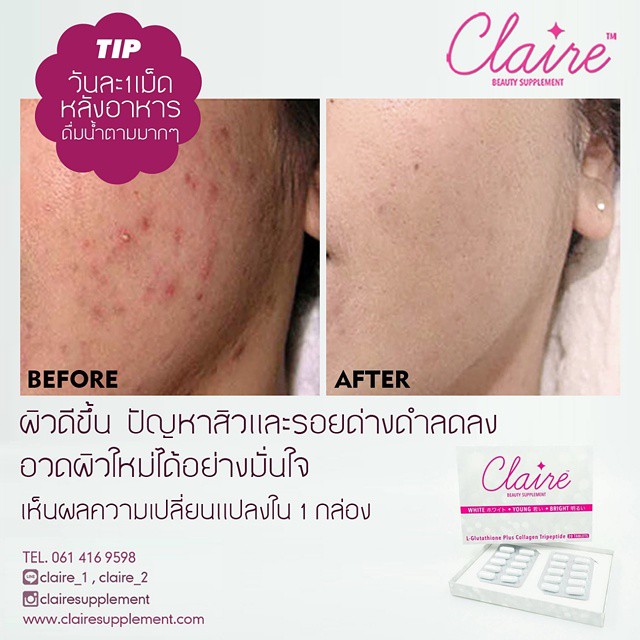 แคลร์ อาหารเสริมผิวขาวใส by วุ้นเส้น(CLAIRE Beauty Supplement)