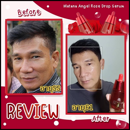 เซรั่มมัทนา Matana Angel Rose Drop Serum เซรั่มหยดกุหลาบนางฟ้า ของแท้ (ส่งฟรี)