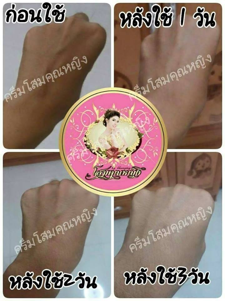 โสมคุณหญิง (Ginseng Khun Ying Cream)