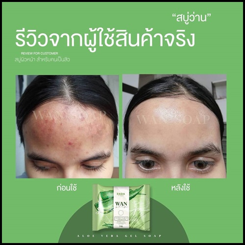 สบู่ว่าน WAN SOAP By RADA ลดสิว ผิวอักเสบ