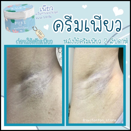 เพียว ครีมทารักแร้ขาว PURE Underarm Treatment Smooth (แพ็คเก็จใหม่)