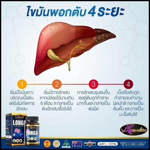 Longa Auswelllife วิตามินบำรุงตับ ของแท้ โปรส่งฟรี