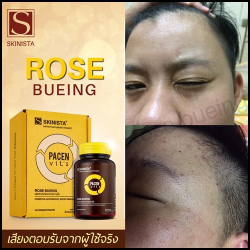 โรเซ่ บูอิ้ง Rose Bueing วิตามินแบบเคี้ยวเม็ดสีชมพู