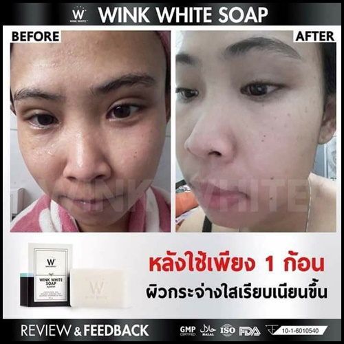 สบู่วิงค์ไวท์ Wink White Soap