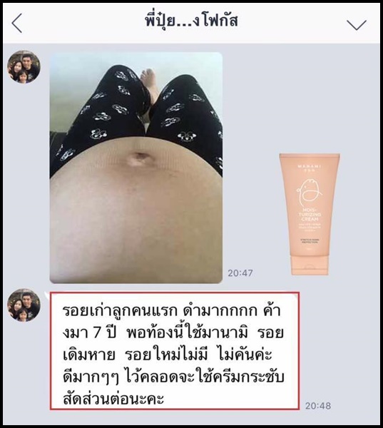 ครีมลดรอยแตกลาย มานามิ (โปรส่งฟรี) Manami Moisturizing Cream Stretch Mark Protection