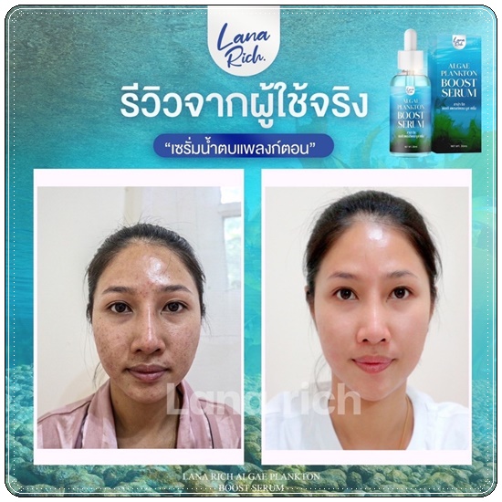 เซรั่มน้ำตบแพลงก์ตอน Algae Plankton Boost Serum LANA Rich (ส่งฟรี)