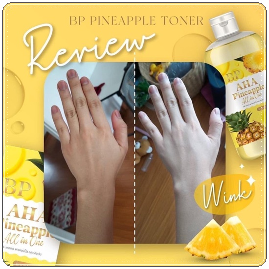 โทนเนอร์สับปะรด BP AHA Pineapple All in One Toner โทนเนอร์เช็ดขาว (1แถม1)
