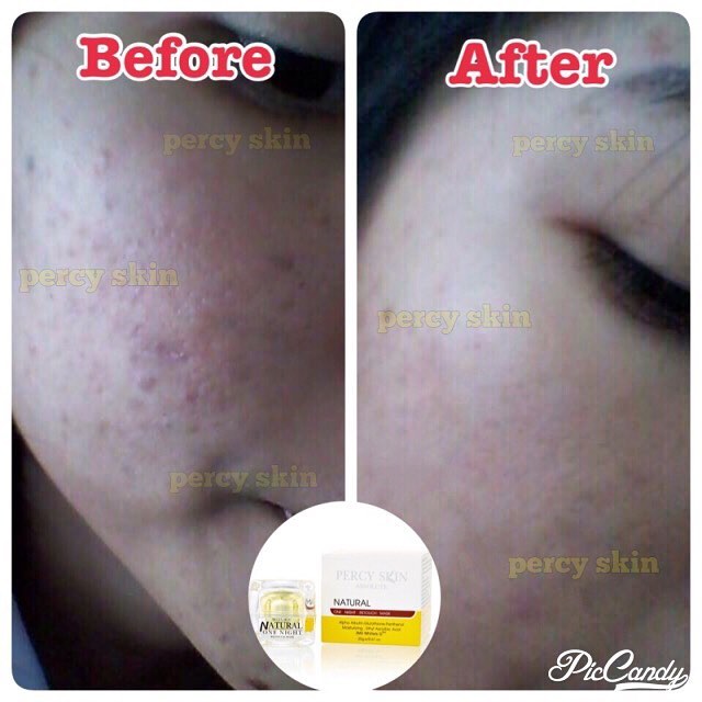เพอร์ซี่สกิน มาส์ก (Percy Skin Absolute Mask)
