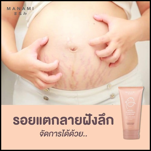 ครีมลดรอยแตกลาย มานามิ (โปรส่งฟรี) Manami Moisturizing Cream Stretch Mark Protection