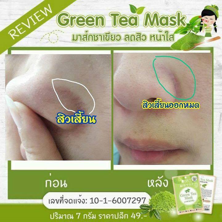 มาส์กชาเขียว BFC ฆ่าสิว หน้าใส Green Tea Mask
