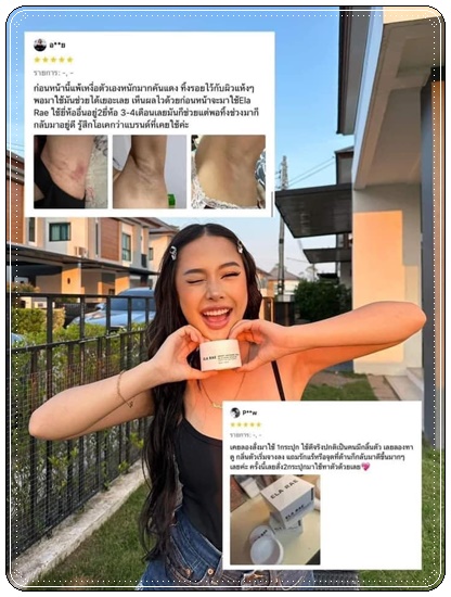 อีล่าแร้ อาร์มพิท ไวท์เทนนิ่ง ครีม ELA RAE Armpit อีล่าแรร์ ครีมทารักแร้
