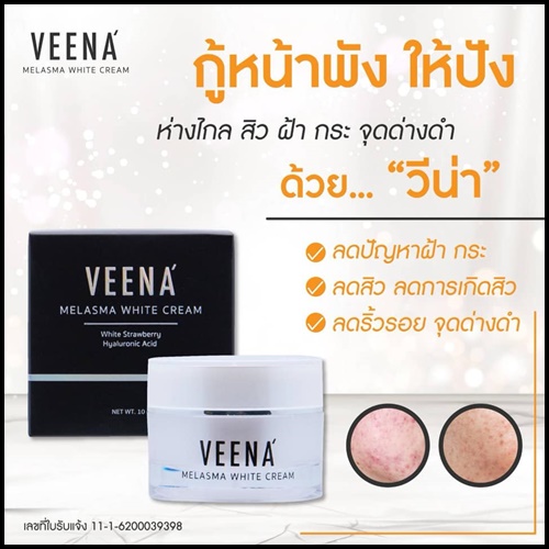 วีน่า เมลาสมา ไวท์ ครีม VEENA Melasma White Cream