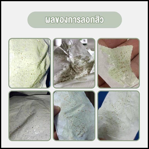 ครีมลอกสิวเสี้ยน ไลฟ์ลี่โนส Nakiz Lively Nose