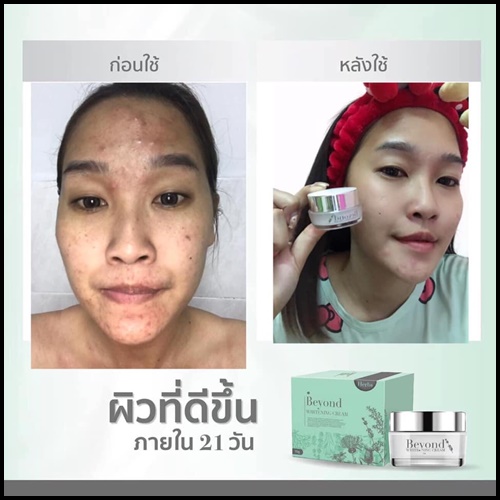 ครีมบียอนด์ Beyond Whitening Cream ครีมหน้าใสใน 21 วัน
