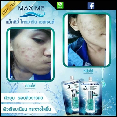แม็กซิมี่ ไตรมารีน เอสเซนส์ MAXIME