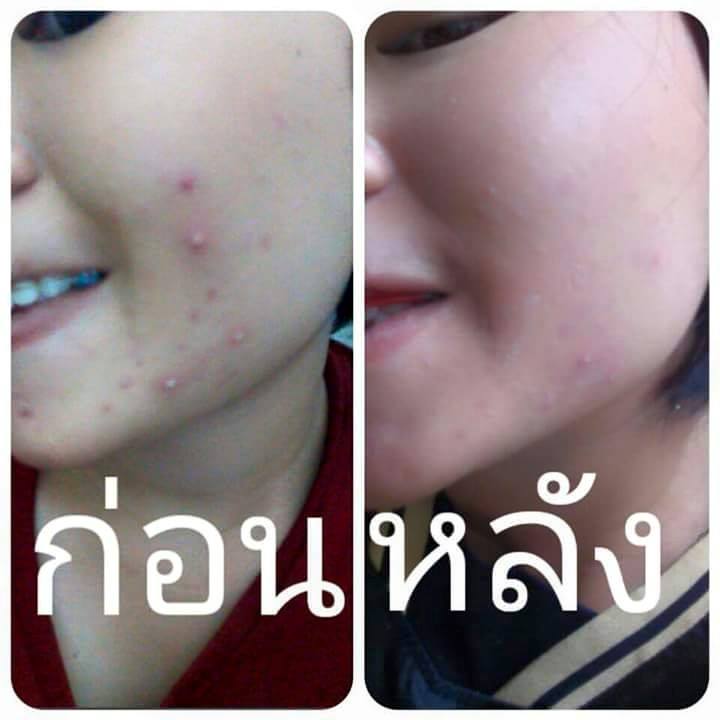สตรอเบอรี่ บริ้ง เซรั่ม (Strawberry Blink Serum)