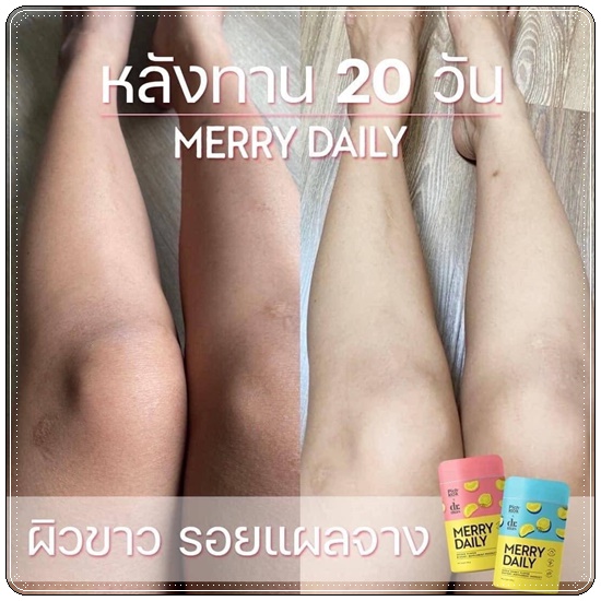 Merry Daily วิตามินเร่งขาวลดเครียด (ของแท้)