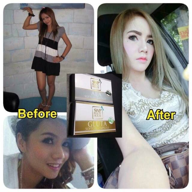 Gluta SWP & ALA SWP วิตามินเร่งขาว