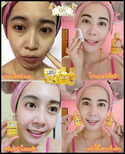 โกล ฮันนี่ เซต Gold Honey Set ตบฝ้า หน้าใส ฆ่าสิว