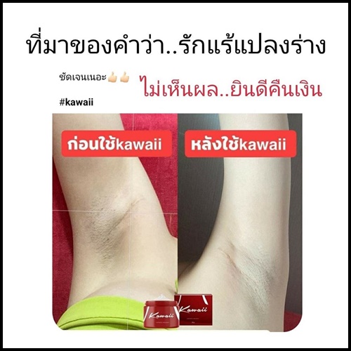 Kawaii ครีมรักแร้ขาว คาวาอี้