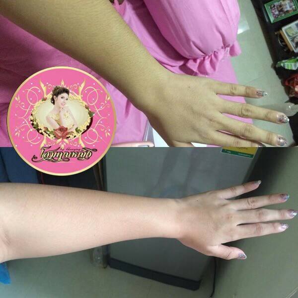 โสมคุณหญิง (Ginseng Khun Ying Cream)