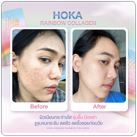 คอลลาเจนสายรุ้ง HOKA Random Rainbow Collagen คอลลาเจน 7 สี (1แถม1 ส่งฟรี)