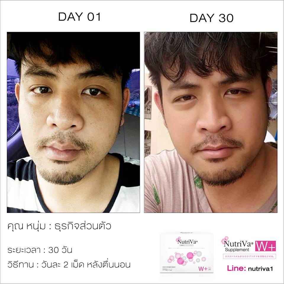ผลิตภัณฑ์เสริมอาหาร นูทริว่า (NutriVa W+ SOD)