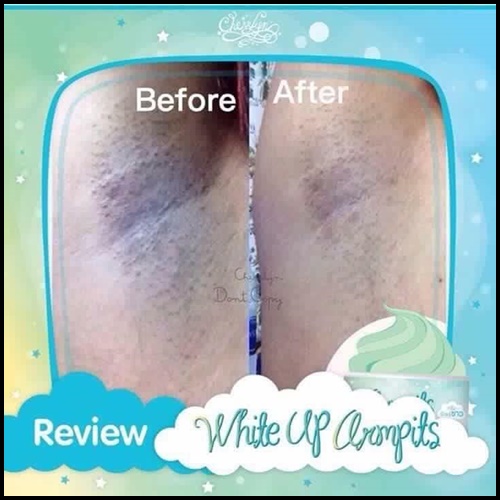 ครีมรักแร้ขาว ไวท์อัพอาร์มพิท White up armpits by Cherrlyn