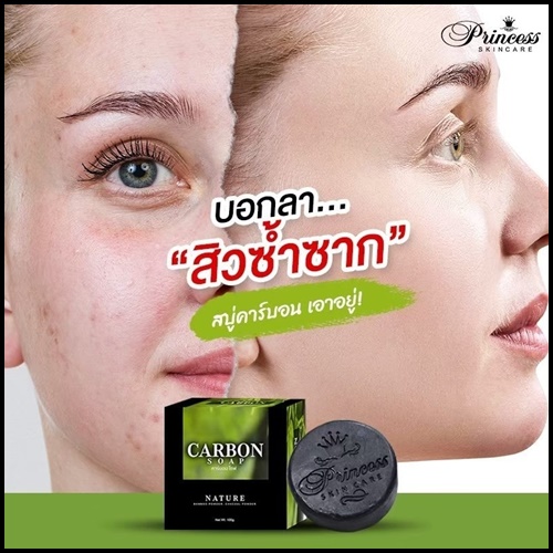 สบู่ดำคาร์บอน Carbon Soap By PrincessSkincare สบู่ดีท็อกซ์ผิว