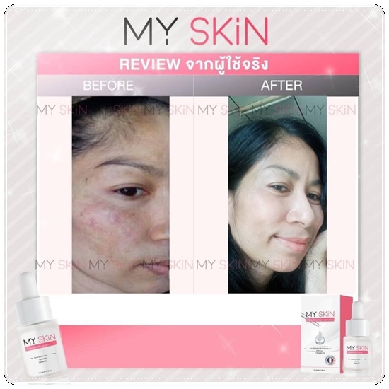 เซรั่ม MY SKin Golw Booster Serum เซรั่มหน้าเงา