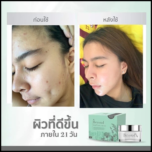 ครีมบียอนด์ Beyond Whitening Cream ครีมหน้าใสใน 21 วัน