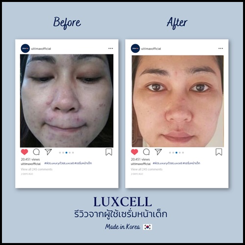 เซรั่มหน้าเด็ก Luxcell คุณภาพระดับสเต็มเซลล์ ของแท้