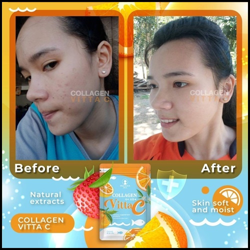 Collagen VittaC BY Precious Skin