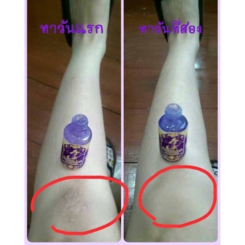 หัวเชื้อแม่มด ระเบิดผิวขาว