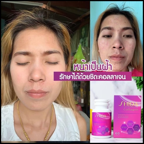 ชิดะคอลลาเจน Shida Collagen