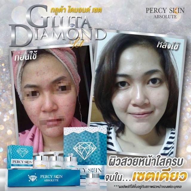 กลูต้า ไดมอนด์ เซต (Gluta Diamond Set By percyskin)
