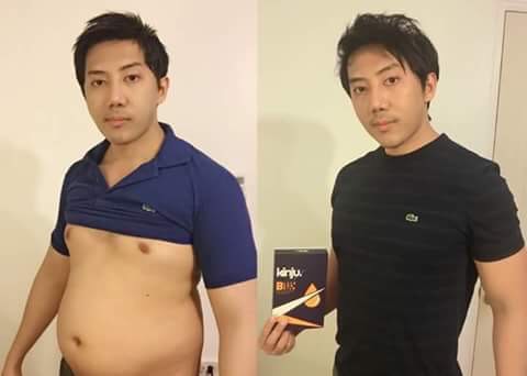kinju คินจู ลดน้ำหนัก โปรโมชั่นพิเศษ